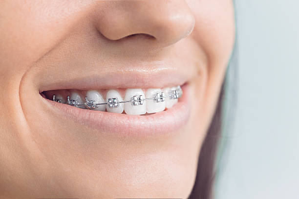 Best Dental Bonding  in Grambling, LA